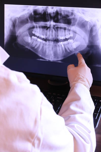 Best Emergency Treatment for Toothache in Steger, IL