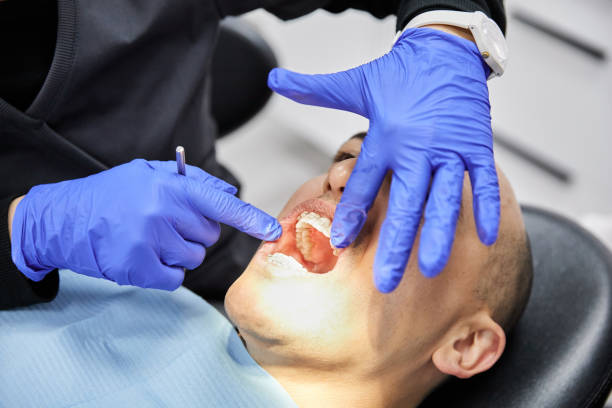 Best Emergency Root Canal Treatment in Steger, IL
