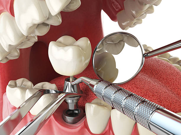 Best Weekend Emergency Dentist in Steger, IL